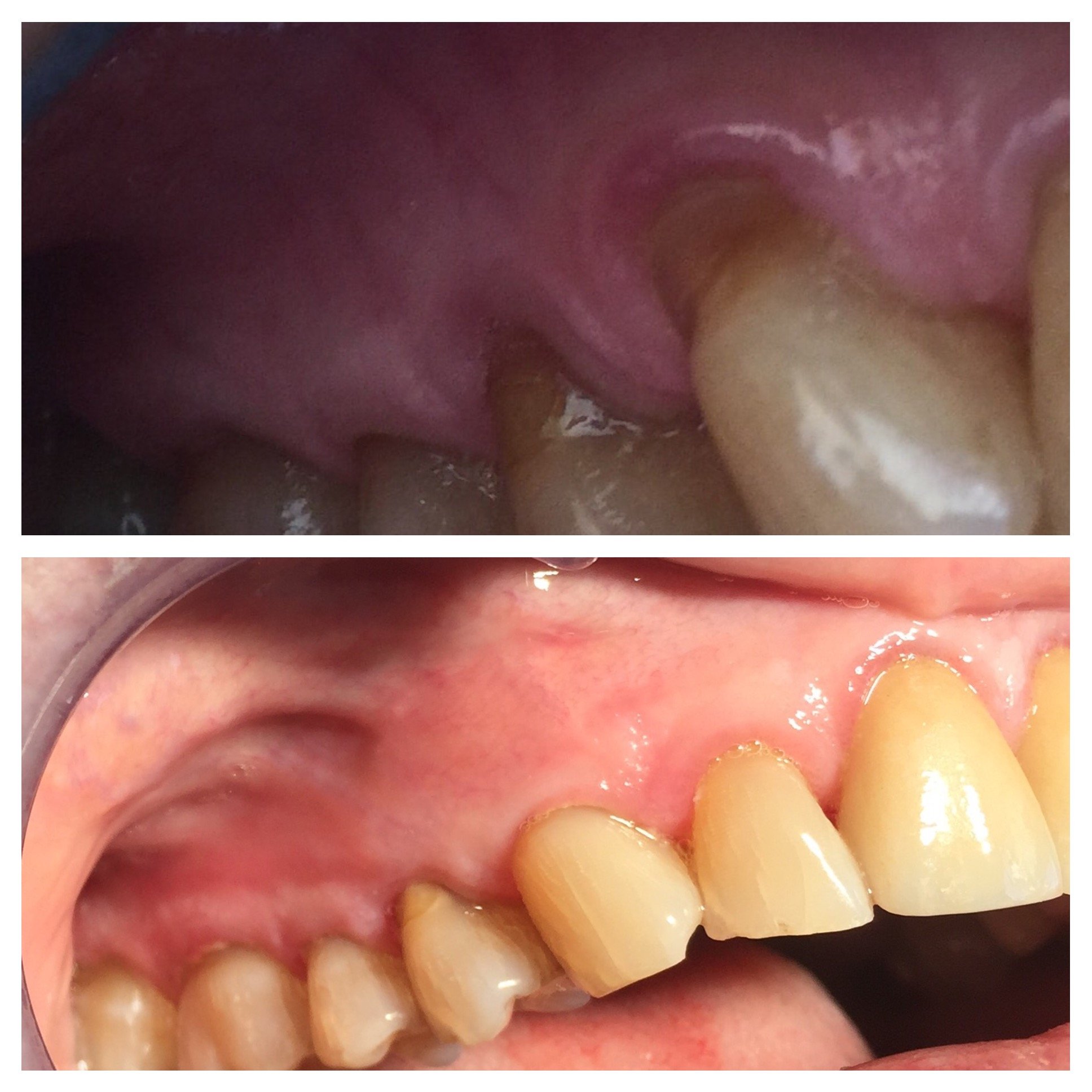 before and after